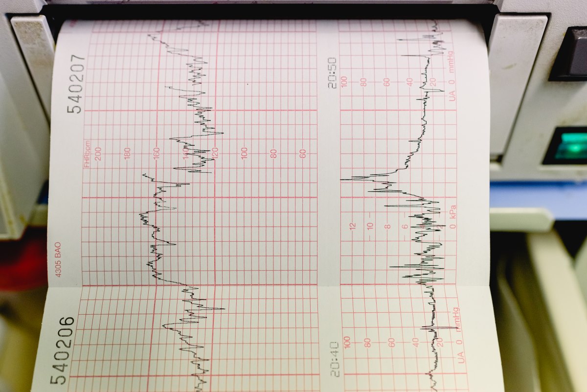 ECG Tracings Mornington