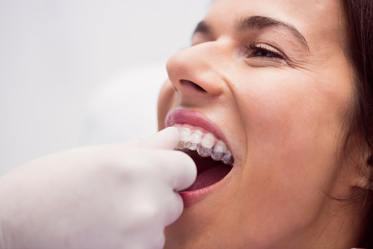 Orthodontics and orthodontic treatment — teeth straightening Mornington Peninsula
