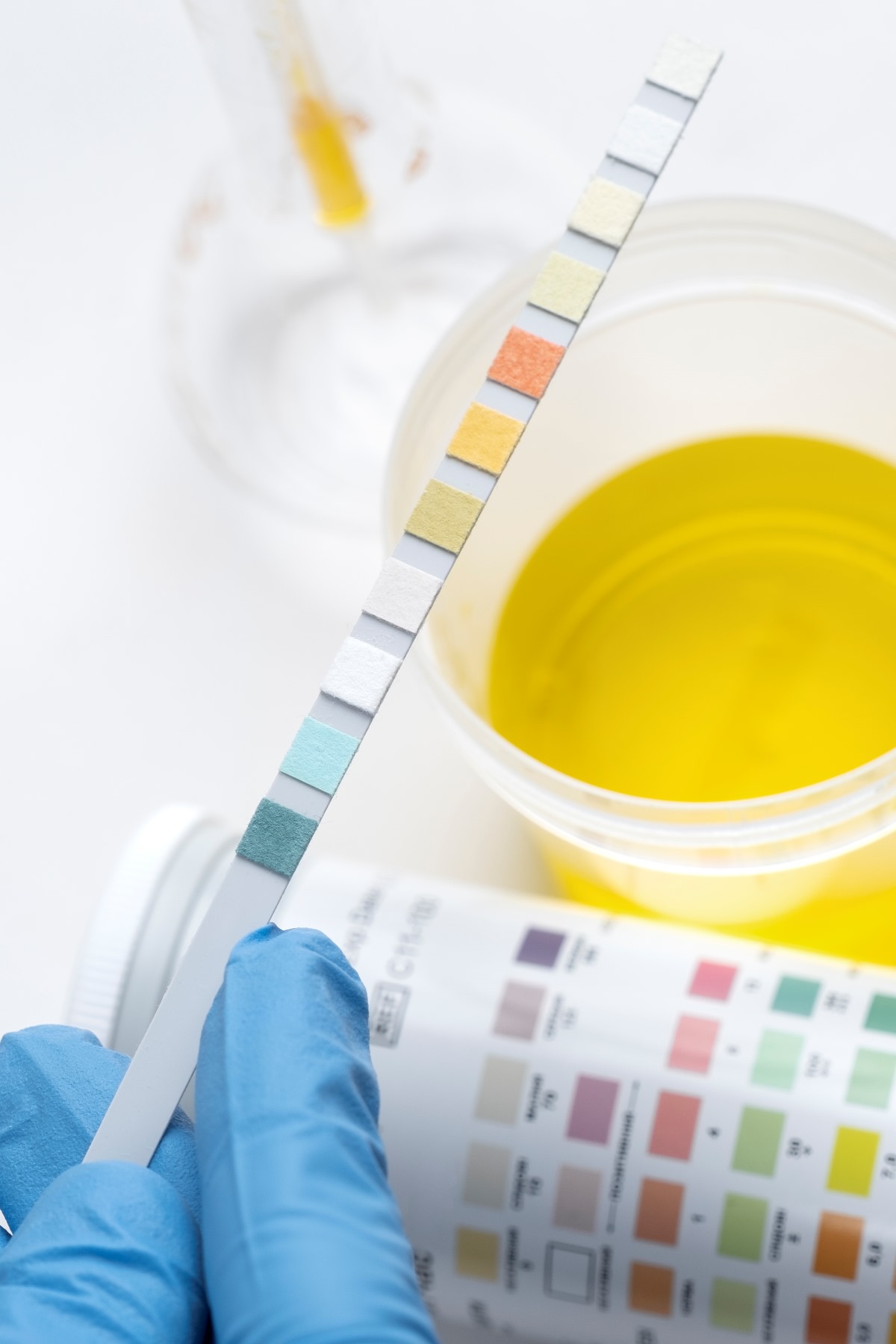 Urine Drug Screens Mornington