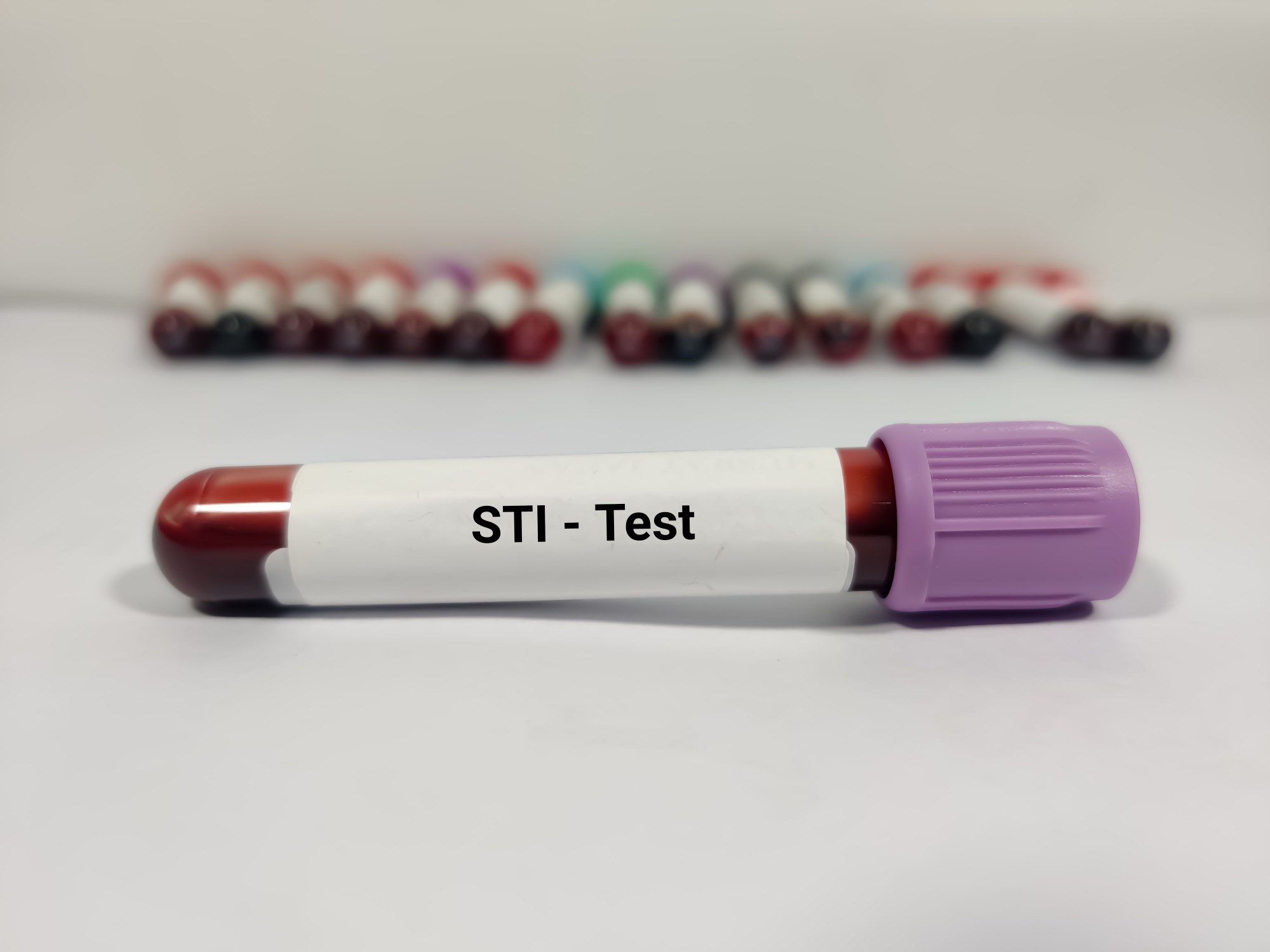 STI testing & treatment